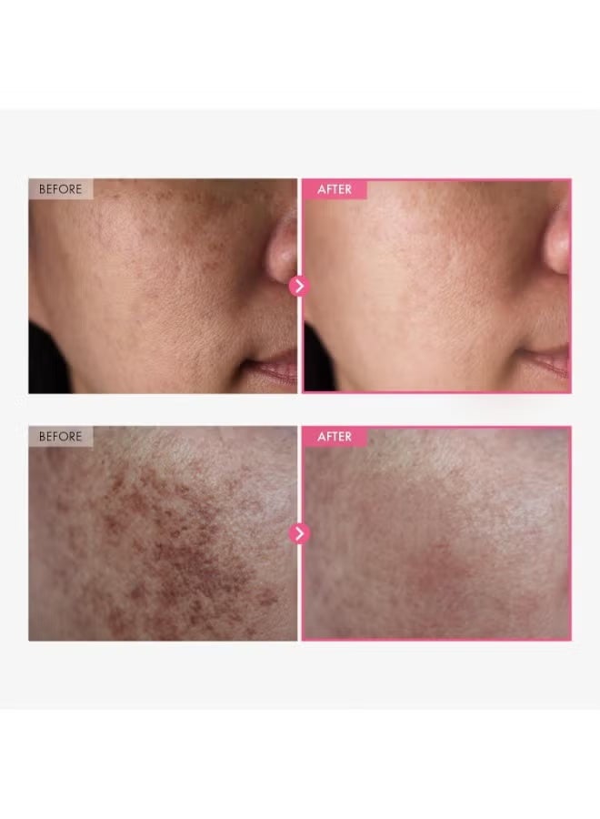 Tosowoong Arbutin 7% + Tranexamic Acid 4% Cream, 70,000ppm Arbutin, 40,000ppm TXA, Niacinamide, Glutathione, Supports Even Skin Tone, Enhances Skin Clarity, Korean Skin Care, 50ml, 1.69 fl.oz - Image 2