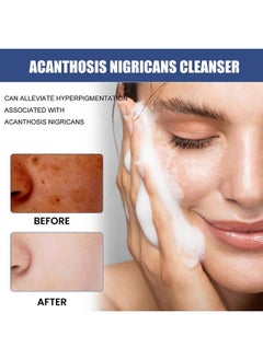 YG LianKai 3Pc 2023 New Cc Cleansing Lotion For Acne & Spots Cream Face Cleansing Lotion Flashing Cleansing(50Ml)  - Image 5