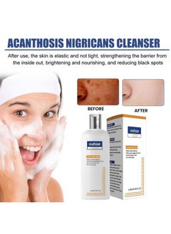 YG LianKai 3Pc 2023 New Cc Cleansing Lotion For Acne & Spots Cream Face Cleansing Lotion Flashing Cleansing(50Ml)  - Image 2