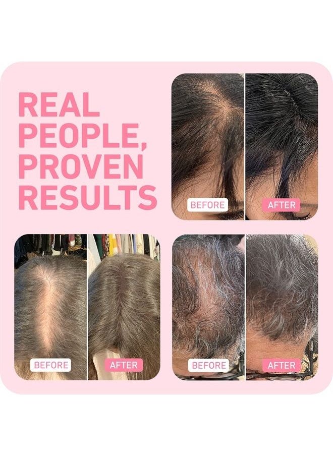 Boldify ﻿﻿BOLDIFY Hair Fibers for Thinning Hair (LIGHT BROWN) Undetectable & Natural - 28g Bottle - Hair Powder - Completely Conceals Hair Loss in 15 Sec - Hair Thickener & Topper for Fine Hair for Women & Me  - Image 4