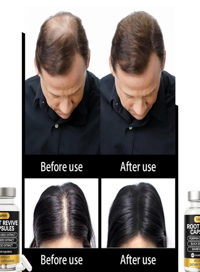 Lumin Root Revive Capsules – Hair Support Supplement for Thinning Hair, Healthy Scalp & Thickness – With Biotin, Black Seed, Bamboo, Saw Palmetto & 17 Nutrient-Rich Ingredients (1) - Image 3