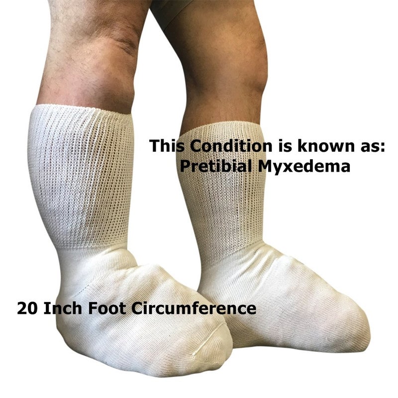 Extra Wide Bariatric Sock for Extreme Lymphedema Calf stretches to 30" (Black) - Image 3