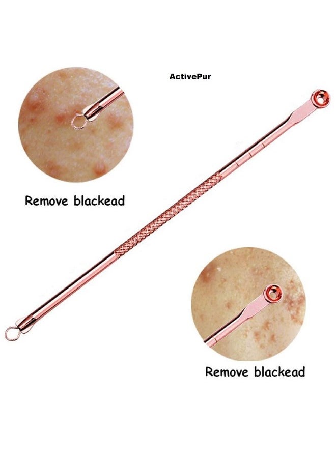 Mroobest - Blackhead Remover Pimple Comedone Extractor Tool Effective Acne Removal Kit Treatment For Blemish Whitehead Pimple Popping Zit Removing For Nose & Face Skin Best Electroplated 4 Pcs Wcase. - Image 1