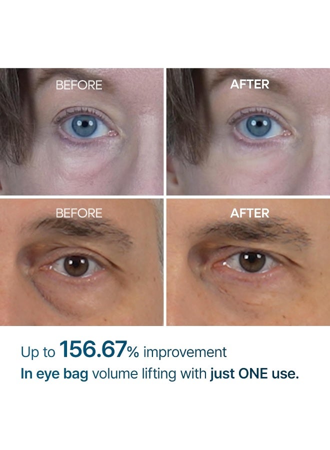 Dr. Melaxin كريم د. ميلكسين آي فالت لانتفاخات العين، الهالات السوداء والخطوط الدقيقة، مضاد التجاعيد، مرطب تحت العين EGF لمكافحة الشيخوخة مع النياسيناميد والسيراميد 0.33 أونصة سائلة. - Image 3