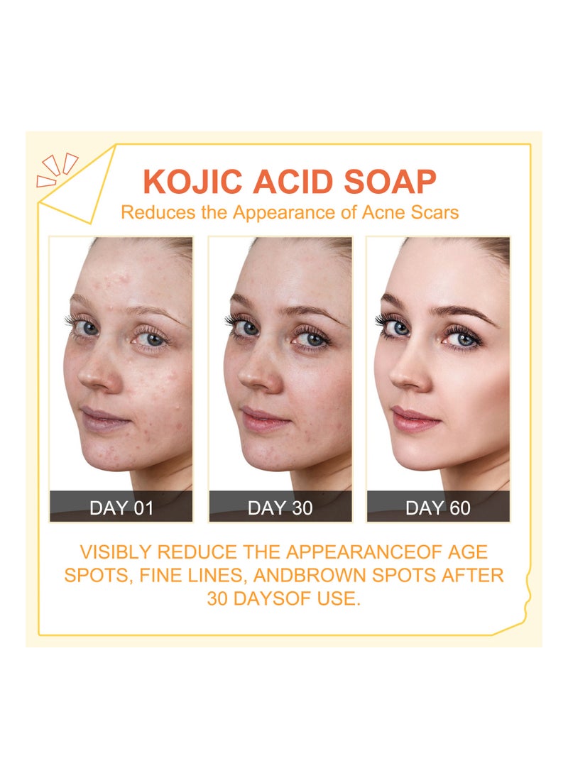 Kojic Acid Soap For Face and Body 100g