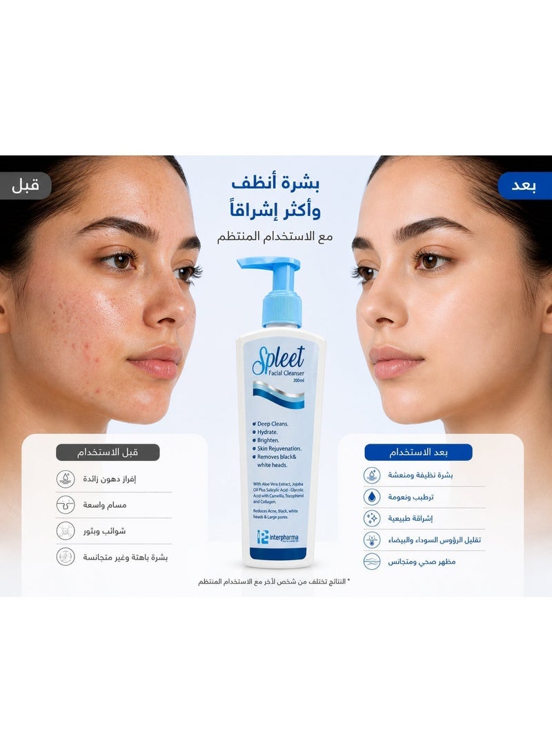 Interpharma Egycare Spleet Facial Cleanser Gel 200ml | Deep Cleansing, Hydrating & Brightening Face Wash | Helps Reduce Blackheads & Whiteheads - Image 5