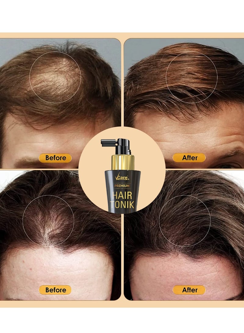 VCare Day Night Hair Tonic with Castor Oil and Olive Leaf Extract for All Hair Type 100ml Pack of 1 - Image 3