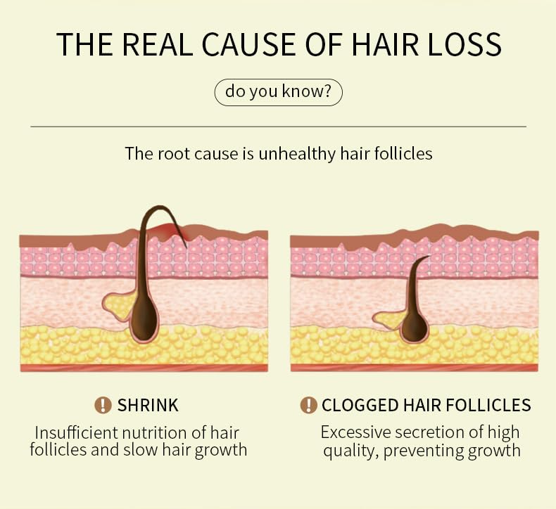 EELHOE Veganic Natural Rosemary Hair Oil for Growth, Improves Dry, Damaged and Thin Hair (1 Pcs) - Image 5