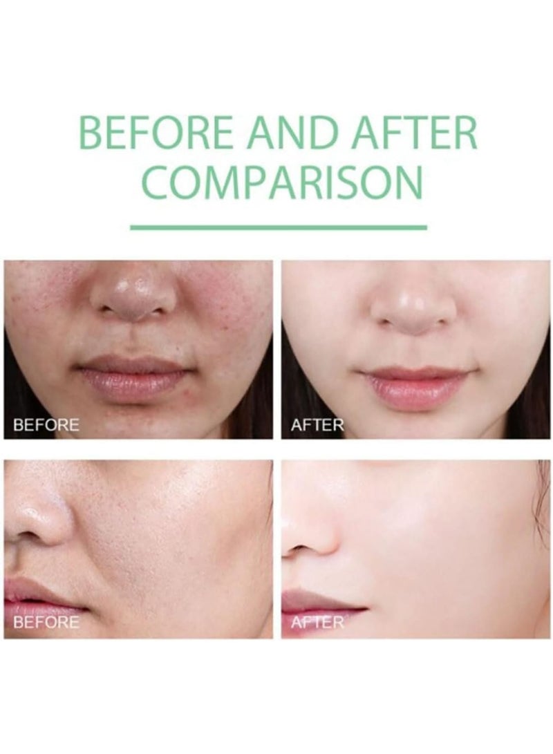 SOLARAE جل تقشير مطهر، 2 قطعة 100 جرام مقشر وجه لطيف، جل مقشر طبيعي لحب الشباب، يحسن لون البشرة وملمسها، تركيبة مضادة للحساسية، مناسب لجميع أنواع البشرة - Image 3