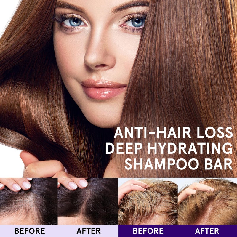 Leafinty Shampoo Bars for Hair Growth, Solid Shampoo Bar for Dry & Damaged Hair, Shampoo Bar with Holder, Deep Hydrating, Rebalance, Sulfate Free, Natural, Sustainable, Vegan, pH Balance, Zero Waste - Image 2