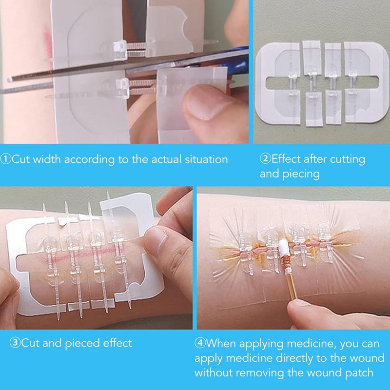 klarako Wound Closure Strips, Wound Closures,Reduce Scar Sutures Wounds, Cuttable Hygienic Zip Stitch Wound Growth,Emergency Wound for Skin Adhesives Bandages Zipper Band Aid - Image 3