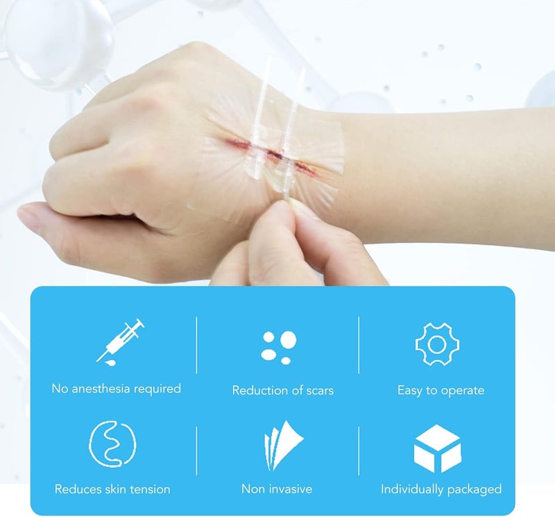 klarako Wound Closure Strips, Wound Closures,Reduce Scar Sutures Wounds, Cuttable Hygienic Zip Stitch Wound Growth,Emergency Wound for Skin Adhesives Bandages Zipper Band Aid - Image 5