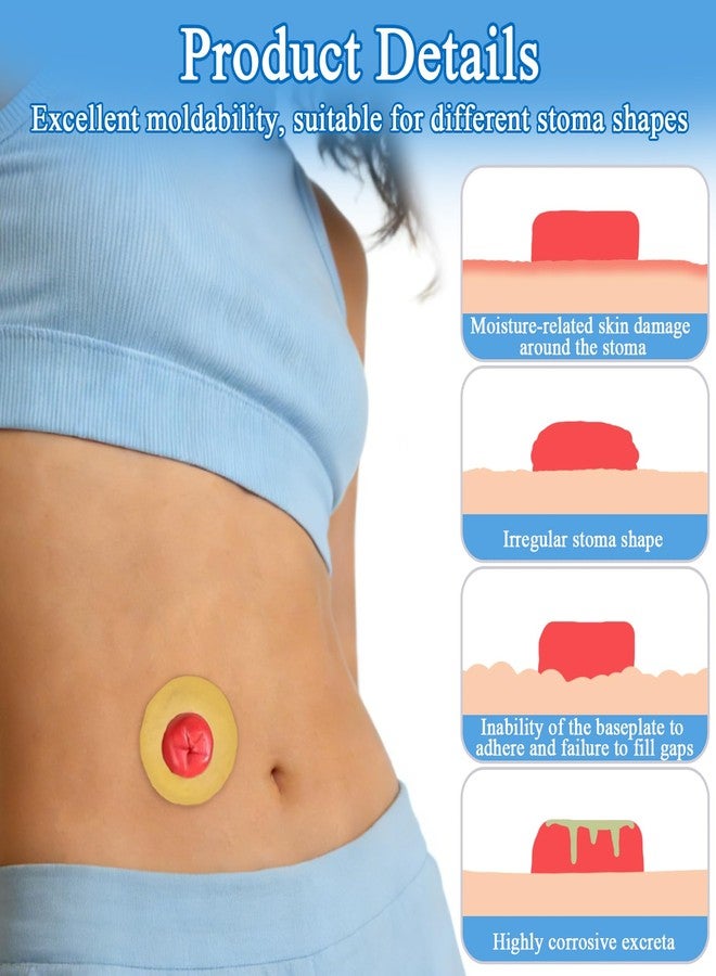QCWN 20PCS Ostomy Barrier Rings 50mm 2mm Thickness Moldable Stoma Sealing Ring Hydrocolloid Skin Extender for Colostomy Bags Leak Free Ostomy Supplies - Image 4