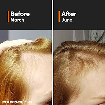 Minimalist Hair Density Serum 18 Hair Growth Serum Procapil Capixyl Redensyl Anagain Baicapil Hair Fall Control Hair Thickening Women Men 30 ml - Image 2