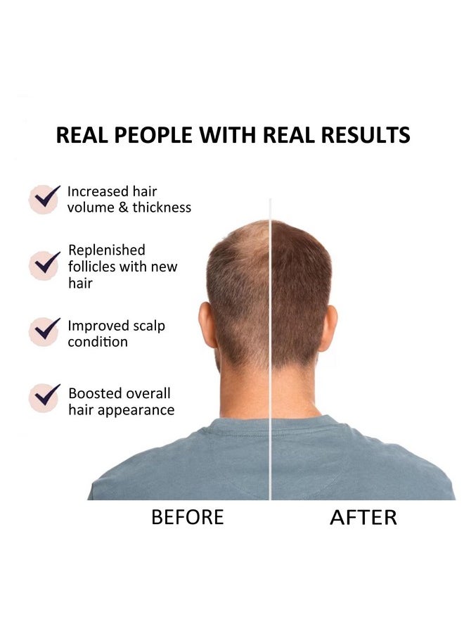 beauty Secrets - Saw Palmetto Hair Growth Serum For Women And Men To Reduce Hair Fall And Stimulate Faster Hair Growth 30Ml | Natural Hair Growth Vitalizer Enriched With Redensyl, Biotin And Rosemary Oil - Image 1