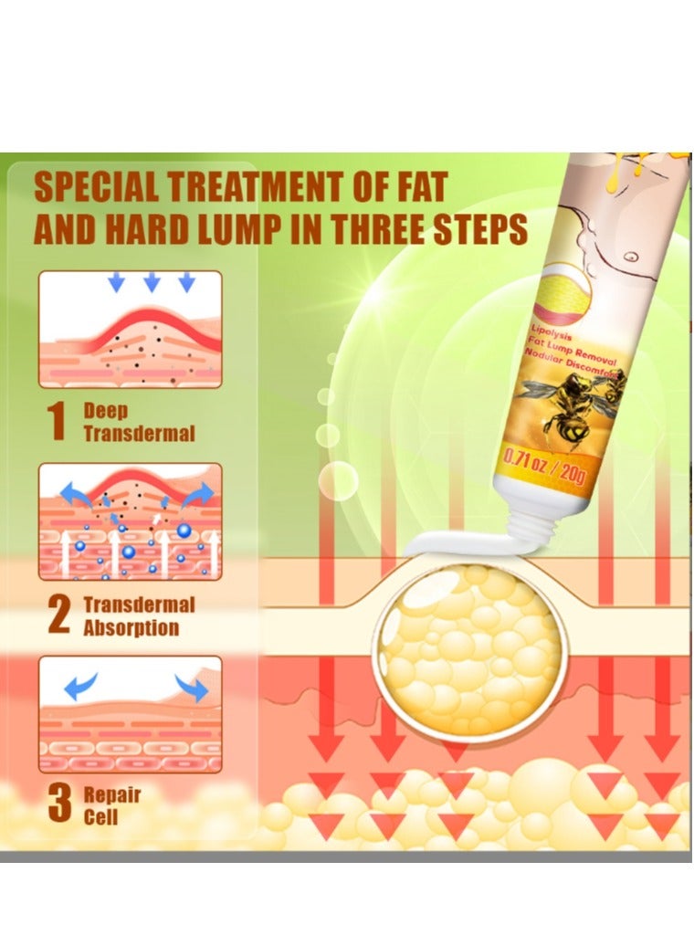 سوميفون كريم إزالة الورم الشحمي من سم النحل 20 جرام، مرهم كريم إزالة الورم الشحمي، كريم القضاء على الورم الشحمي، تخلص من كتل الورم الشحمي الدهنية - Image 3