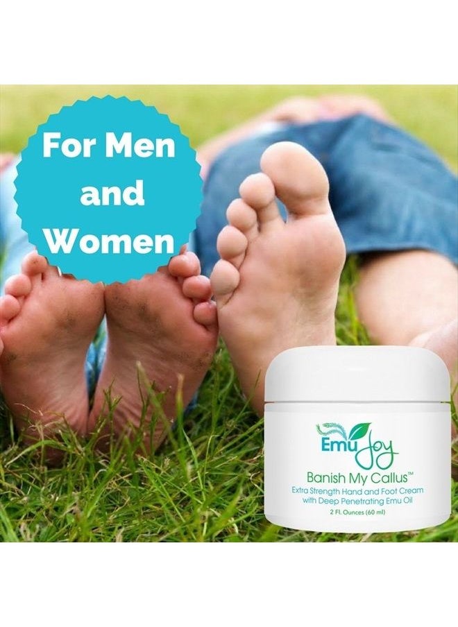 Emu Joy - Banish My Callus Foot Callus Cream Hand Callus Remover – For Softening Rough Hard Dry Skin on Feet Hands Knees Elbows - Image 1