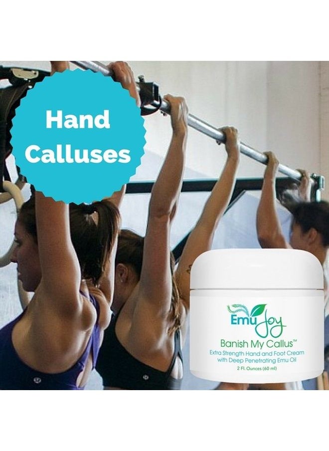 Emu Joy - Banish My Callus Foot Callus Cream Hand Callus Remover – For Softening Rough Hard Dry Skin on Feet Hands Knees Elbows - Image 1