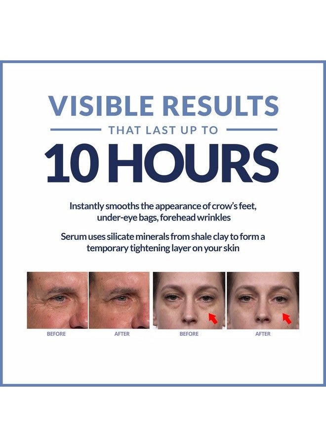 Plexaderm - Rapid Reduction Eye Serum Advanced Formula Anti Aging Serum Visibly Reduces Undereye Bags Wrinkles Dark Circles Fine Lines & Crow'S Feet Instantly Instant Wrinkle Remover For Face - Image 1