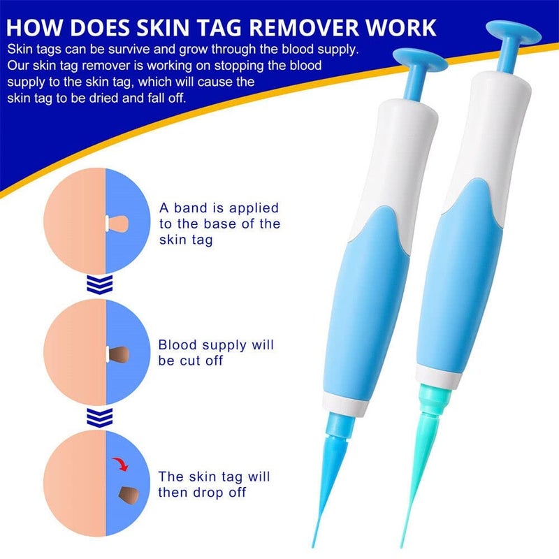 GION Easy Remove Small to Large 2mm8mm Sized Skin Tags Remover Kit at Home Beauty Salon Parlor Warts Remover Skin Face Tag Remover Kit For Men Women 1Pcs - Image 3