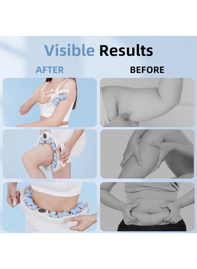 general Cellulite Massage Roller for Legs, Anti Cellulite Massage Tool with Detachable, Fats Remover for Legs, Thighs, Butt, Fascia Massage Tool for Lymphatic Drainage & Deep Tissue Pain Relief (Blue) - Image 5