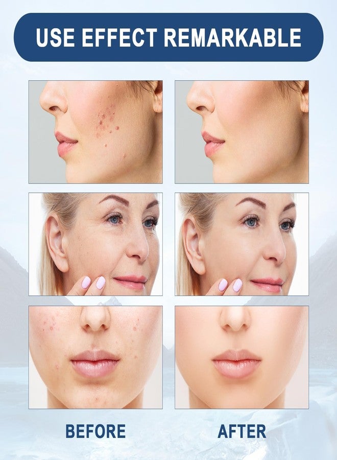 Botou Facial Serum, Liquid Solution Anti Aging Serum, Promotes Skin Collagen Production, Diminishes Fine Lines & Wrinkles(2pcs) - Image 3