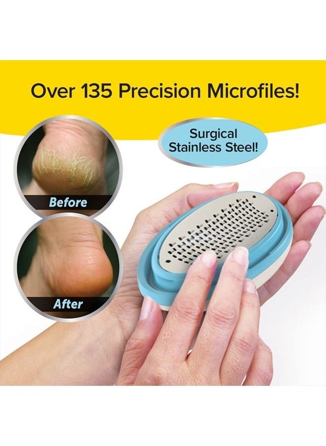 PedEgg - Ped Egg Classic Callus Remover, As Seen On TV, New Look, Safely and Painlessly Remove Tough Calluses & Dry Skin to Reveal Smooth Soft Feet, 135 Precision Micro-Blades, Traps Shavings Mess-Free - Image 1