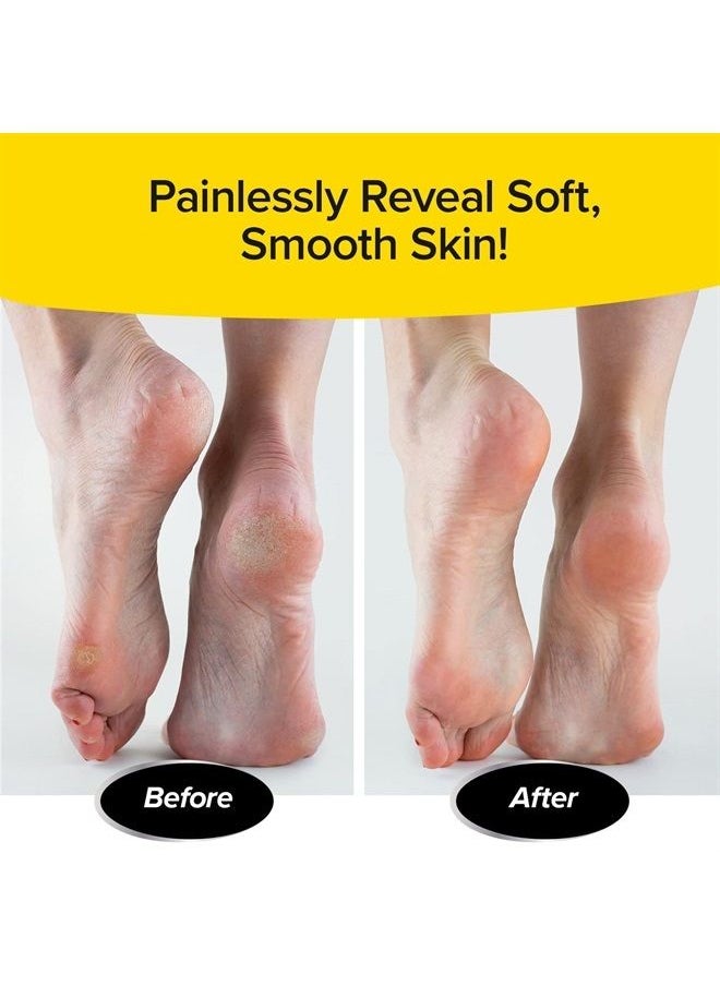 PedEgg - Ped Egg Classic Callus Remover, As Seen On TV, New Look, Safely and Painlessly Remove Tough Calluses & Dry Skin to Reveal Smooth Soft Feet, 135 Precision Micro-Blades, Traps Shavings Mess-Free - Image 1