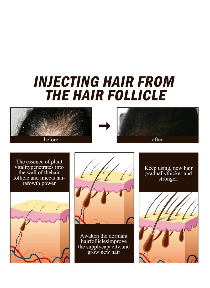 OUHOE - Hair Growth Serum Spray, Ginger Hair Spray for Hair Loss and Regrowth, Anti Hair Loss Essence, Ginger Hair Growth Oil for Baldness, Thin Hair, Fast Growth, Hair Follicle Repair, for Men and Women 20ml - Image 1