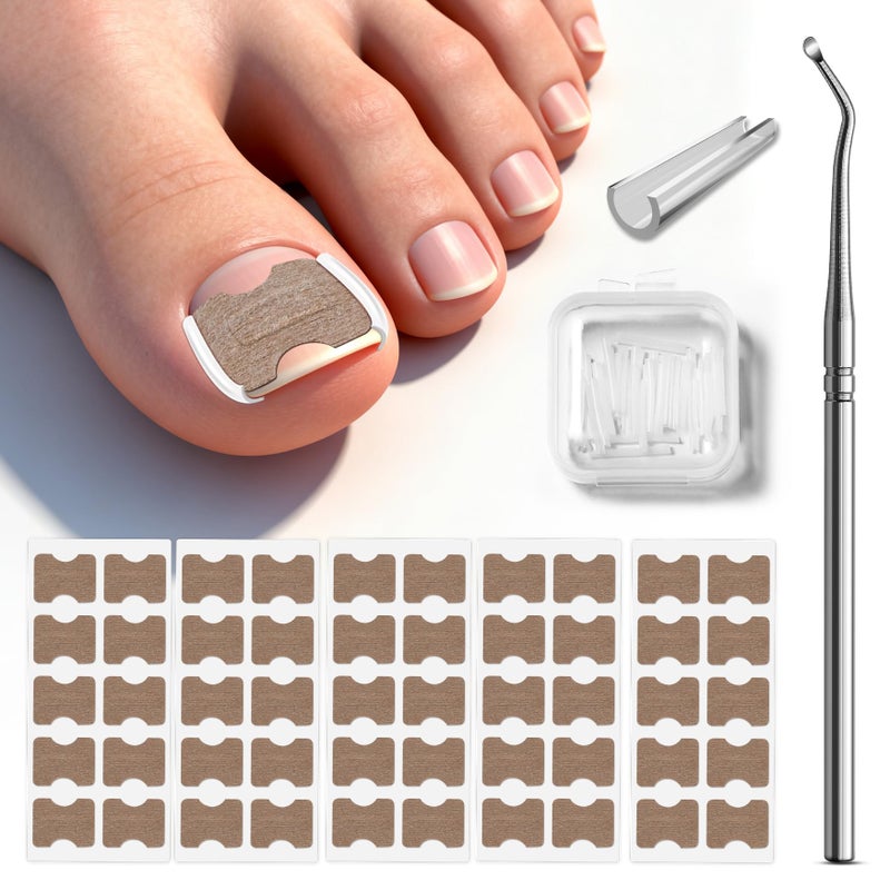 BALUCA 2025 Upgraded Ingrown Toenail Corrector Kit | Professional Ingrown Toenail Treatment & Pain Relief | Home Pedicure Tool Set with Breathable Corrector Strips & Toenail Tools - Image 1