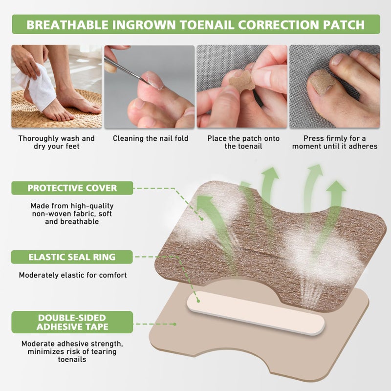 BALUCA 2025 Upgraded Ingrown Toenail Corrector Kit | Professional Ingrown Toenail Treatment & Pain Relief | Home Pedicure Tool Set with Breathable Corrector Strips & Toenail Tools - Image 4