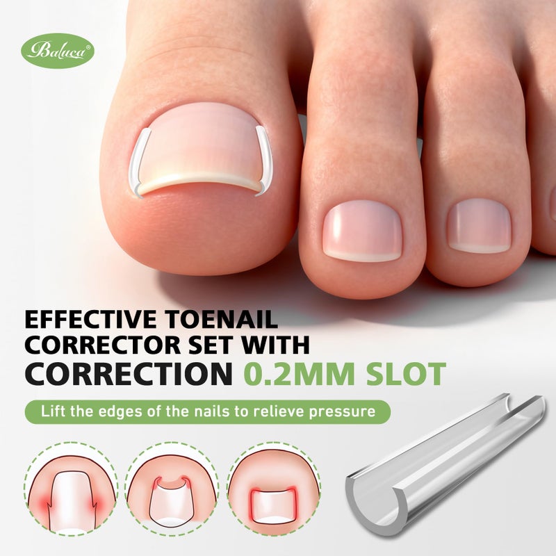 BALUCA 2025 Upgraded Ingrown Toenail Corrector Kit | Professional Ingrown Toenail Treatment & Pain Relief | Home Pedicure Tool Set with Breathable Corrector Strips & Toenail Tools - Image 3