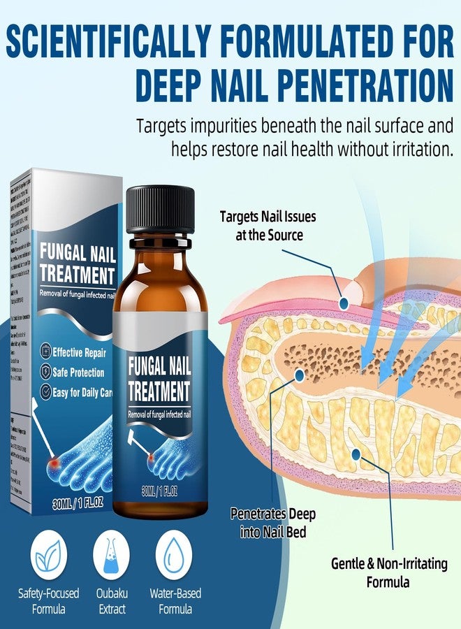 Nexkayee Extra Strength Toenail Fungus Treatment - Nail Repair Solution to Restore Damaged, Discolored, and Brittle Nails with Fast-Acting Natural Formula for Healthy Growth, 30ml - Image 2