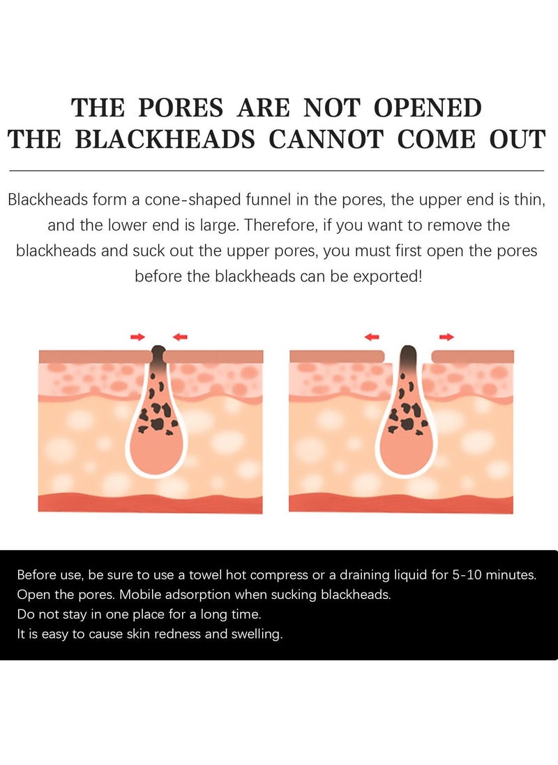 EELHOE Remove nose blackheads and pimples, clean and shrink pores with nose patches(10 Count)Remove nose blackheads and pimples, clean and shrink pores with nose patches(10 Count) - Image 5