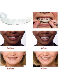 Crazylife Mouth Guard for Grinding Teeth and Clenching Anti Grinding Teeth Custom Moldable Dental Guard，Dental Night Guards,Stops Bruxism, Eliminates Teeth Clenching  - Image 4