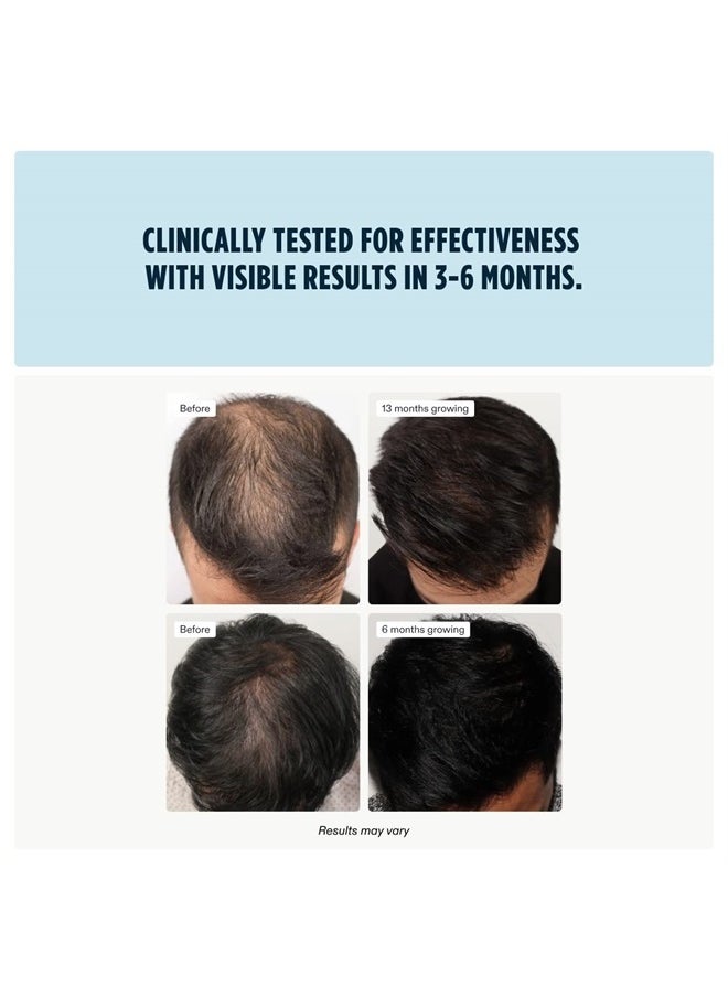 NUTRAFOL - Men's Hair Growth Supplements, Clinically Tested for Visibly Thicker Hair and Scalp Coverage, Dermatologist Recommended - 1 Month Supply - Image 1