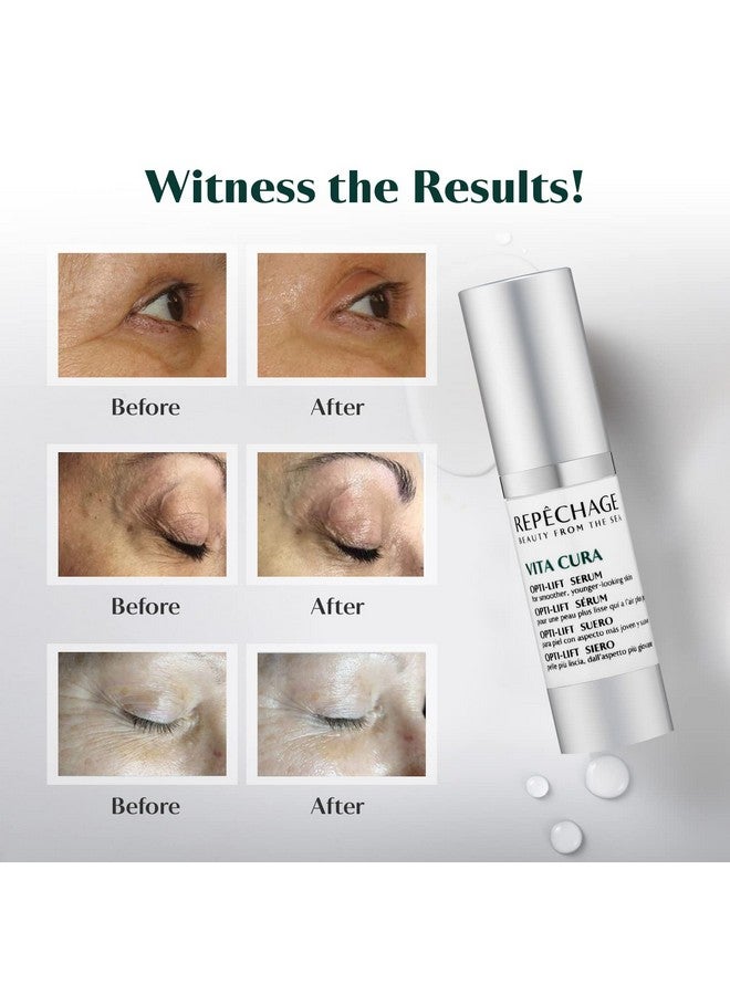 ريبيتشيدچ مصل فيتا كورا أوبتي ليفت ذو تأثير فوري لشد محيط العين لتنعيم مظهر تجاعيد قدم الغراب مع الببتيدات 0.5 أونصة سائلة. أوز. - Image 4