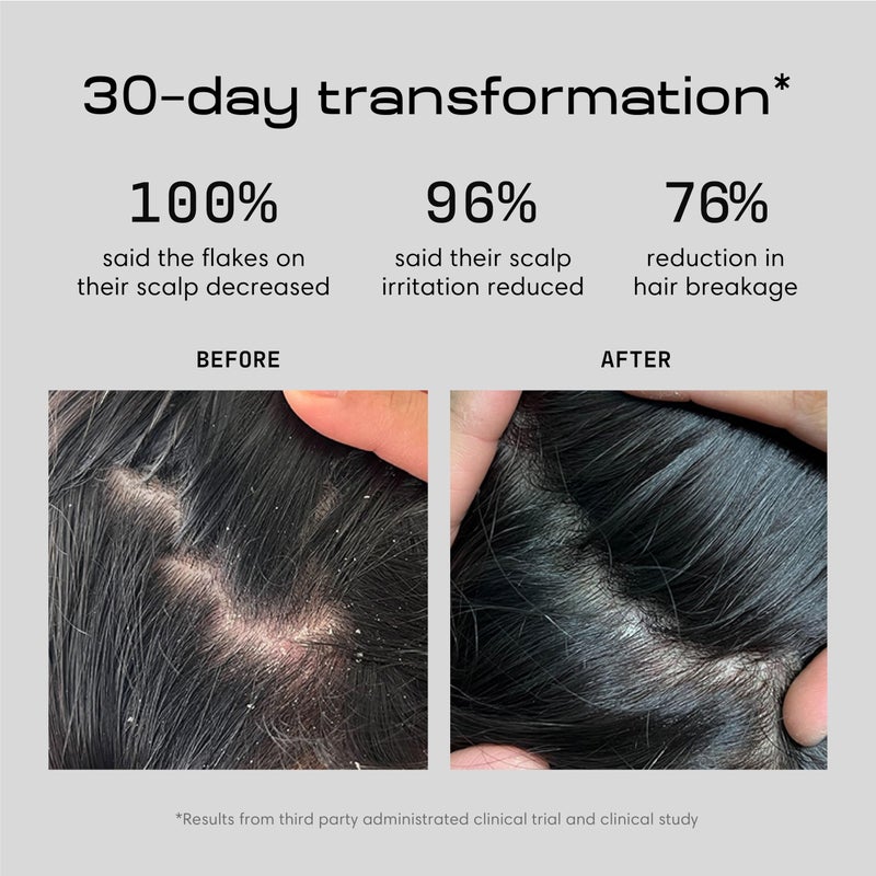 Jupiter Restoring Scalp Serum - Soothing Anti-Dandruff Serum for Men & Women for Flaky, Oily, & Dry Scalp - Restores Barrier and Reduces Breakage & Flakes - Color-Safe, Sulfate-Free, Paraben-Free - Image 3