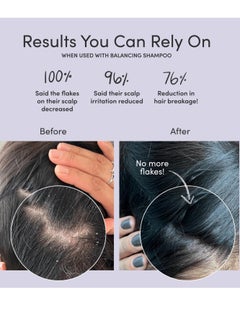 JUPITER Jupiter Anti-Dandruff Scalp Serum - Leave On Restoring Serum For Dry, Itchy & Oily Scalp - Aloe Vera & Niacinamide - Color Safe - Vegan - Cruelty, Paraben, Phthalate & Sulfate Free - 3.4 fl. Oz  - Image 3