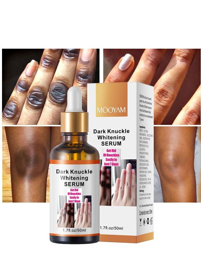 MOOYAM Dark Knuckle Whitening Serum 7 days Treatment for Dark Spots in Hand and Feet Knuckles Exfoliating Improves Dullness Powerful Whitening Effect for Men and Women 50ml  - Image 1