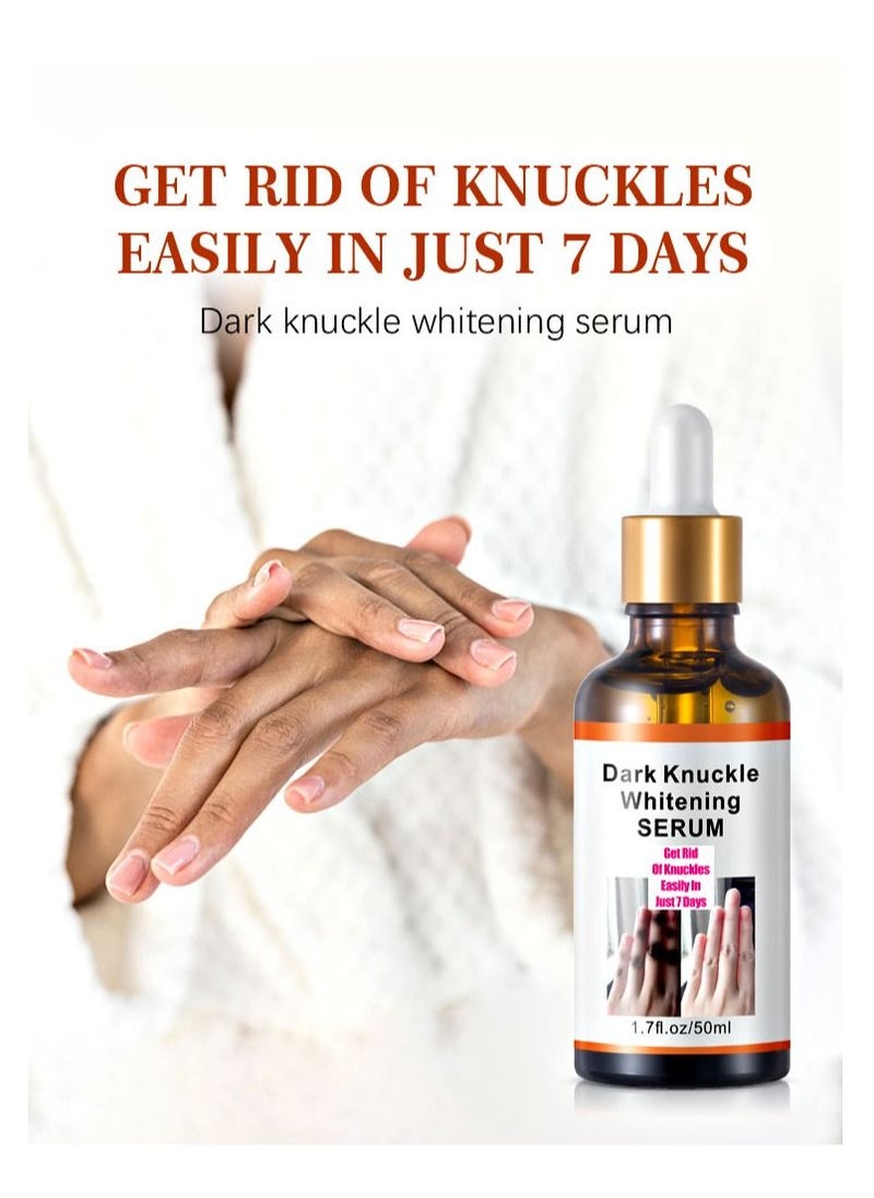 MOOYAM Dark Knuckle Whitening Serum 7 days Treatment for Dark Spots in Hand and Feet Knuckles Exfoliating Improves Dullness Powerful Whitening Effect for Men and Women 50ml  - Image 4