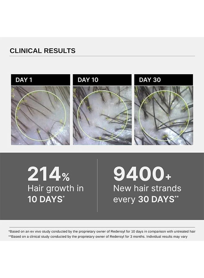 CARVENCHY Advanced Hair Growth Serum| 3% Redensyl - 2x Better Results than Minoxidil | + 4% Anagain + 3% Baicapil | Rosemary, Biotin | Hair growth & Hair fall control serum for Women & Men | 30ml - Image 4
