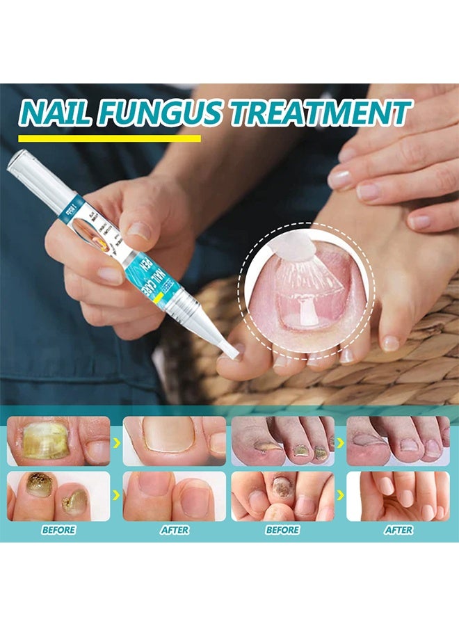 HBESTY Nail Care Pen, Fungal Treatment Solution, Anti Fungal Nail Repair Pen, Nail Fungus Nursing Liquid, Daily Hands And Feet, Nail Care, Nail Lotion, Thickening Soft Nails, Fungal Nail Repair Pen For Nail Damage - Image 4