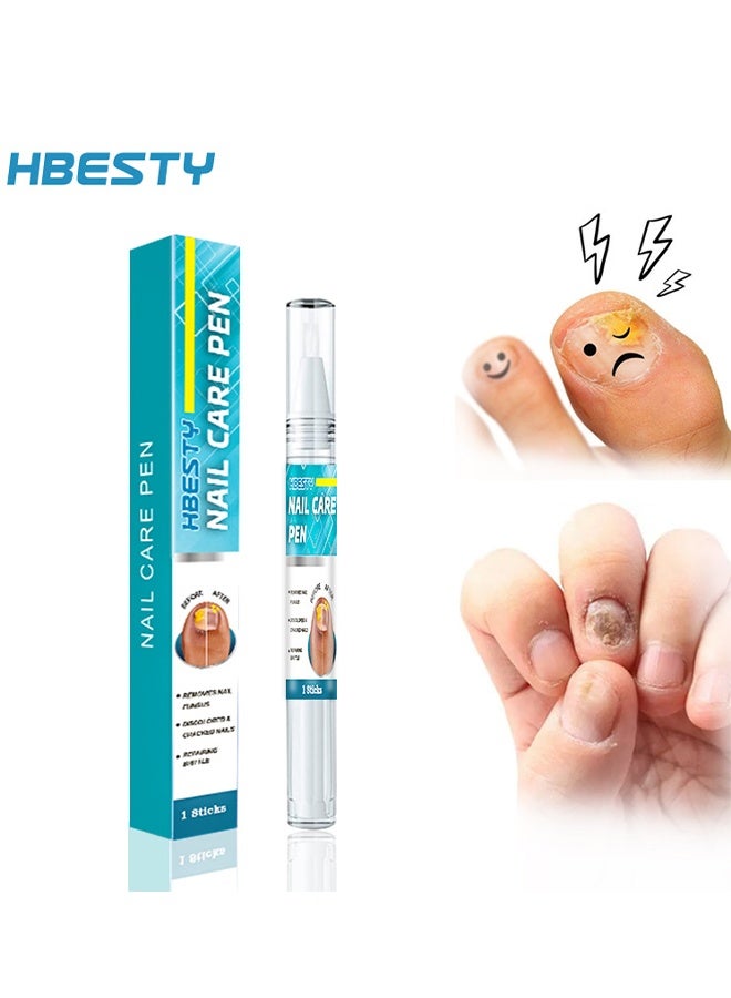 HBESTY Nail Care Pen, Fungal Treatment Solution, Anti Fungal Nail Repair Pen, Nail Fungus Nursing Liquid, Daily Hands And Feet, Nail Care, Nail Lotion, Thickening Soft Nails, Fungal Nail Repair Pen For Nail Damage - Image 1