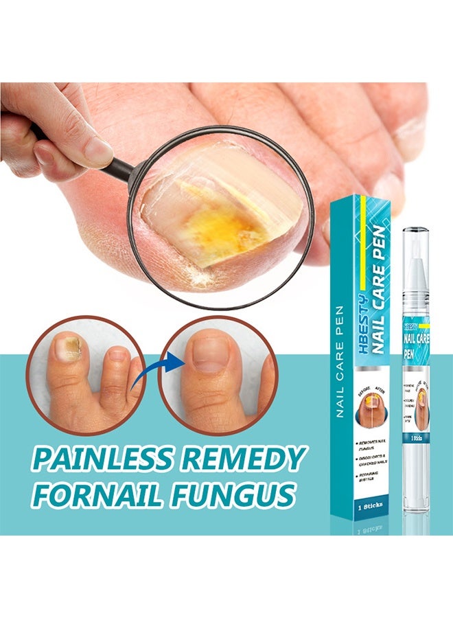 HBESTY Nail Care Pen, Fungal Treatment Solution, Anti Fungal Nail Repair Pen, Nail Fungus Nursing Liquid, Daily Hands And Feet, Nail Care, Nail Lotion, Thickening Soft Nails, Fungal Nail Repair Pen For Nail Damage - Image 3