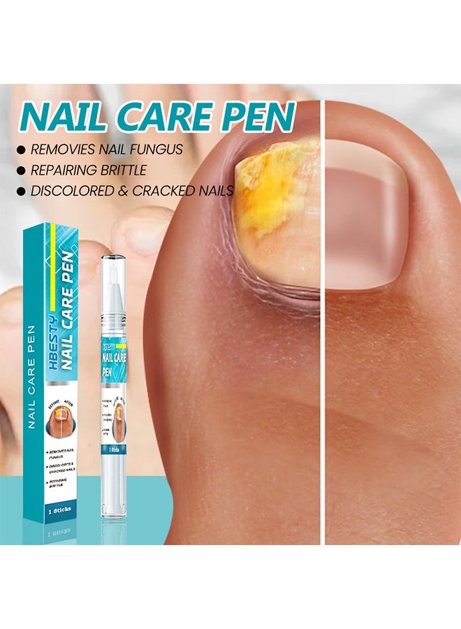 HBESTY Nail Care Pen, Fungal Treatment Solution, Anti Fungal Nail Repair Pen, Nail Fungus Nursing Liquid, Daily Hands And Feet, Nail Care, Nail Lotion, Thickening Soft Nails, Fungal Nail Repair Pen For Nail Damage - Image 2