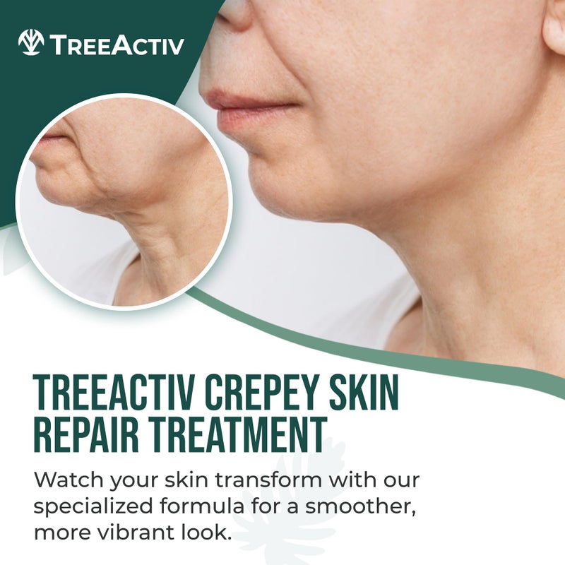 TreeActiv Crepey Skin Repair Cream, 8 oz, Firming Formula with Hyaluronic Acid & Shea Butter to Deeply Moisturize and Tighten Dry, Wrinkly Crepe Skin, 500+ Uses - Image 2