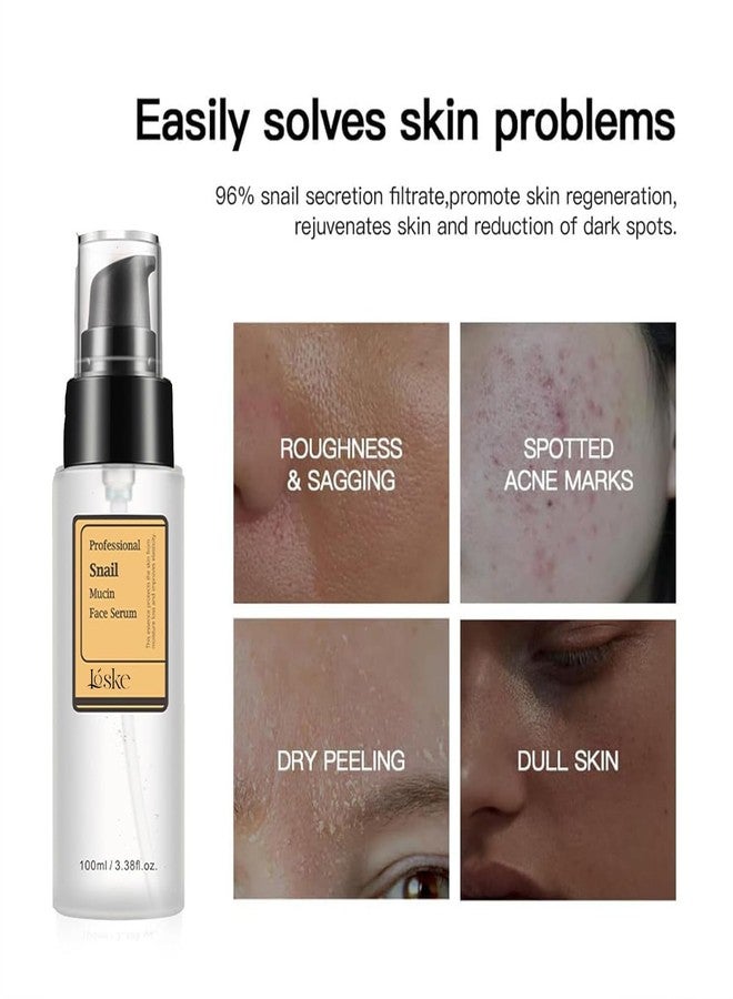 Loske Snail Mucin Serum, Snail Secretion Filtrate, Snail Mucin, Power Repairing Essence - Image 5