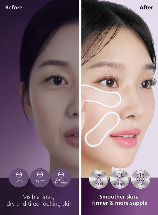 DWEasyDerm EasyDerm PDRN Patch – Under Eye & Smile Line Care, 4 Patches | K-Beauty Korean Skincare with Collagen & EGF, PDRN Eye Mask, Self-Care Essential, Summer & Travel Essentials - Image 3