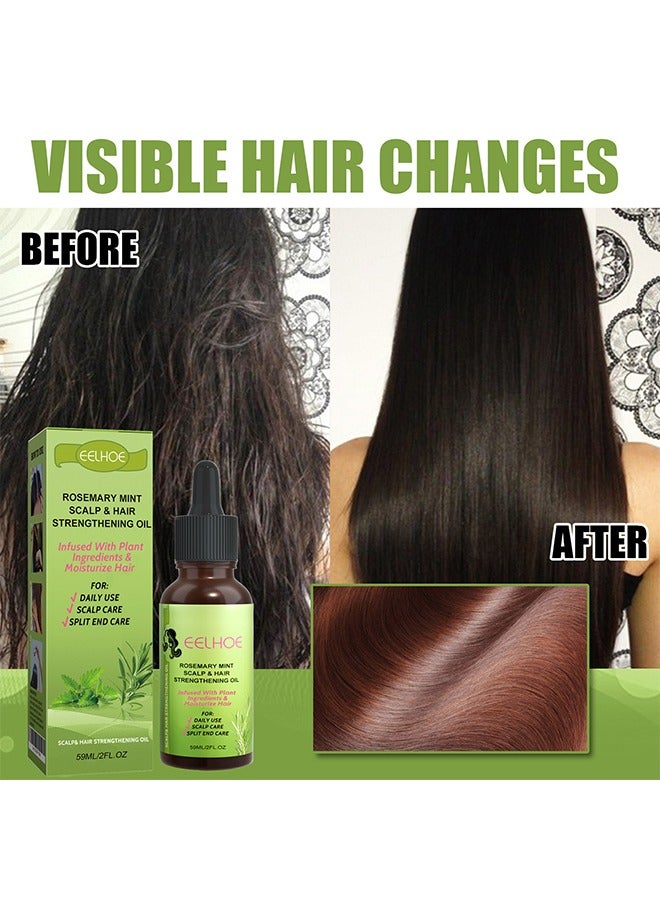 إيلهو روزماري النعناع فروة الرأس وزيت تقوية الشعر ، علاجات تساقط الشعر ، مساعدات ضد ترقق الشعر ، علاج إعادة نمو الشعر 59 مل - Image 5